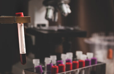 blood-test-result-for-the-new-rapidly-spreading-co-2023-11-27-04-51-05-utc